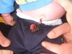 Newborn Cord Care
